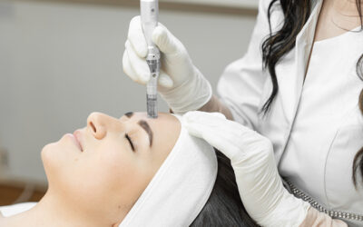 Addressing Specific Skin Concerns with Secret RF Microneedling